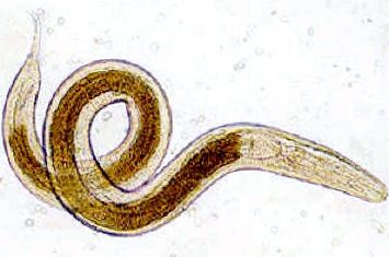 Острица (Enterobius vermicularis), (изображение с сайта www.medtrust.ru)