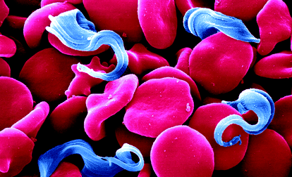 На этой электронной микрофотографии (J?rgen Berger and Dr. Peter Overath, Max Planck Institute for Developmental Biology) показан паразит крупным планом - трипаносомы на фоне эритроцитов.