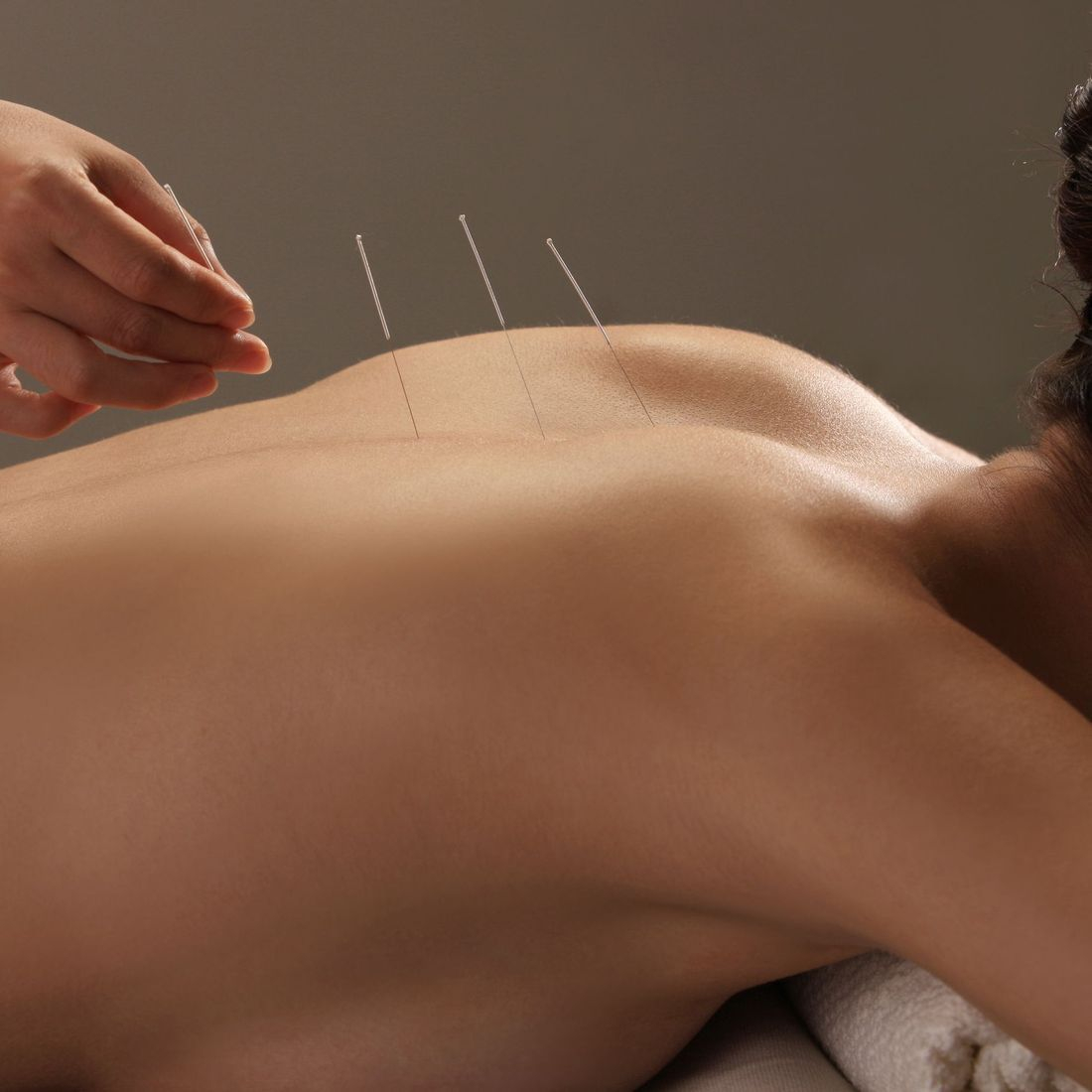 ispolzovanie akupunktury dlya uluchsheniya zdorovya