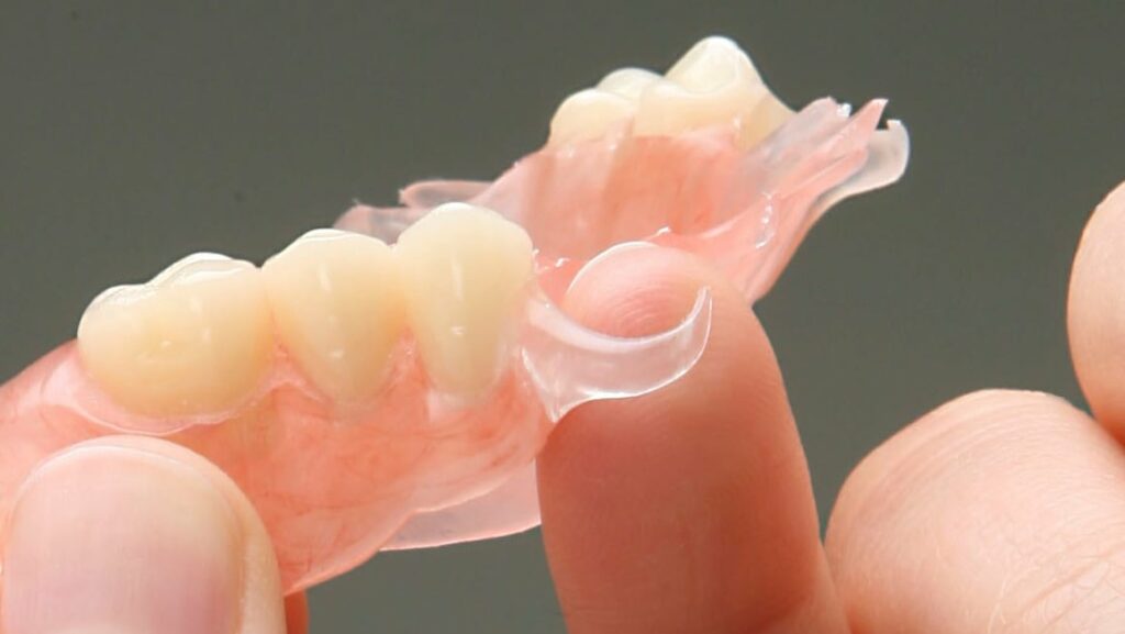 zubnye protezy akri fri preimushhestva i nedostatki