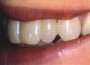 Зубные проблемы и их лечение